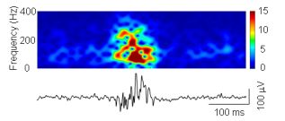 Analysis of neural dynamics