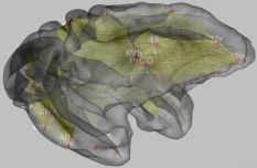 Brain Connectivity